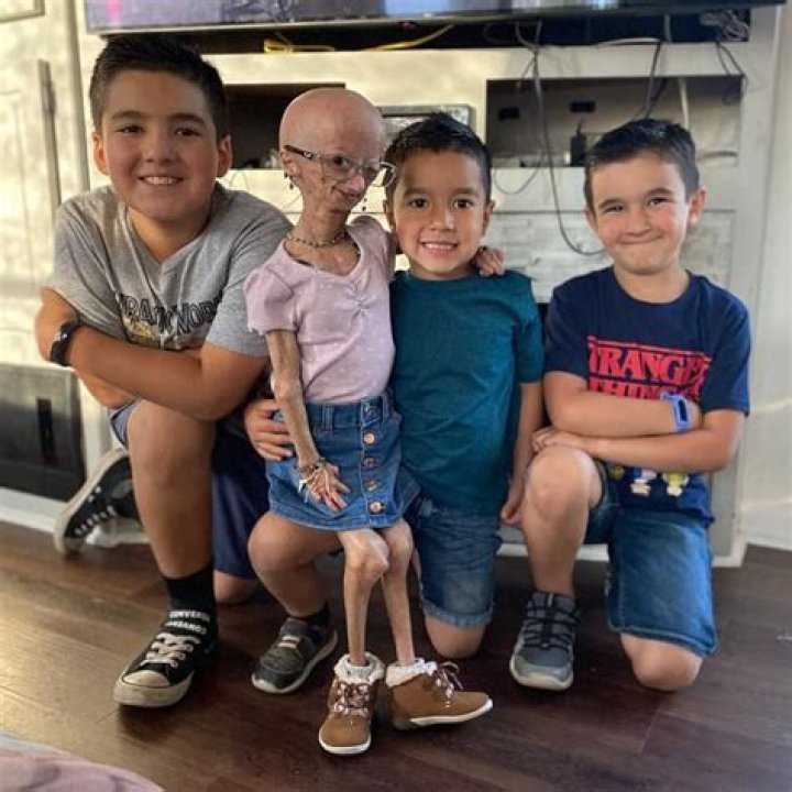 Adalia Rose Bio (Wiki) 