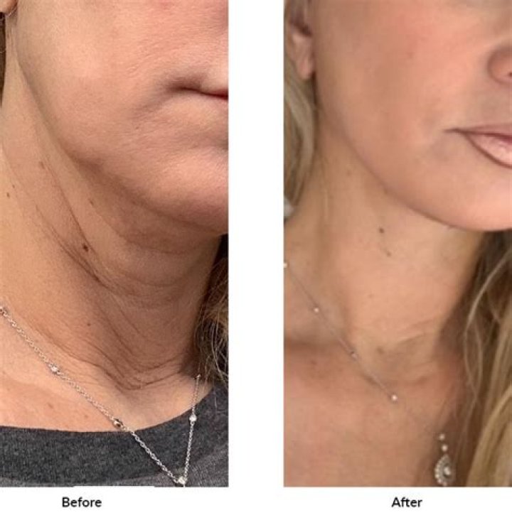 Frances McDormand: Botox & plastic surgery erase the ‘roadmap’ of life