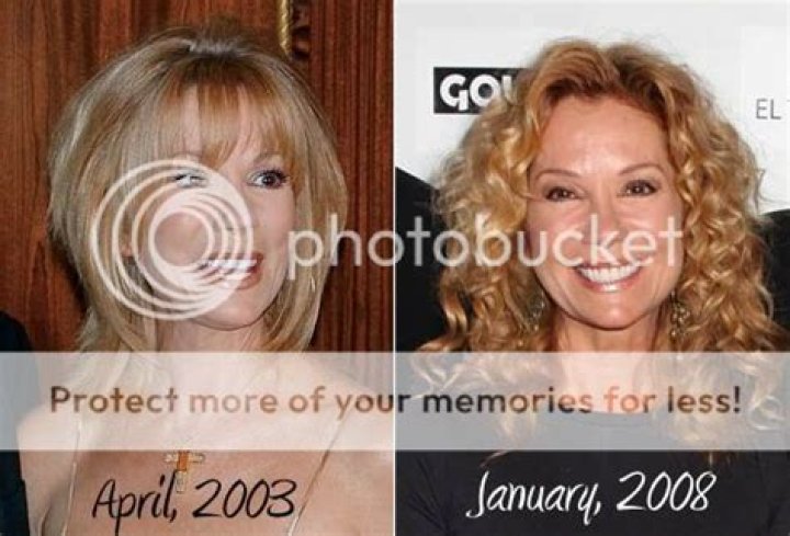 Kathie Lee Gifford looking super plastic