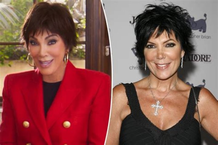 Kris Jenner debuts her freshly “lifted” cat-face, looks more “surprised” than ever