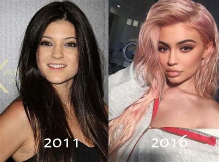 Kylie Jenner denies getting nose job, butt implants, breast implants & more