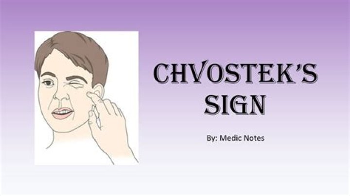 What does a positive chvostek’s sign indicate quizlet?
