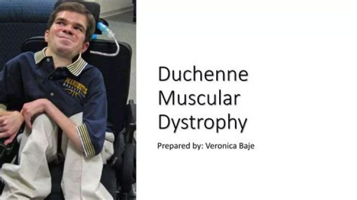 What famous people have Duchenne muscular dystrophy?